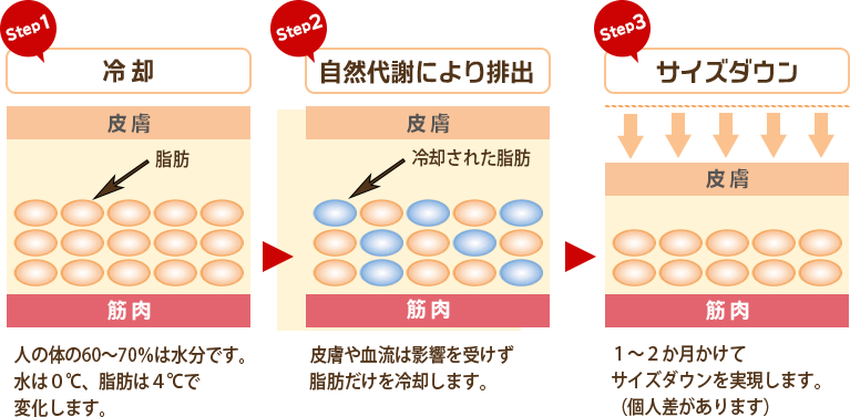 脂肪冷却のメカニズム