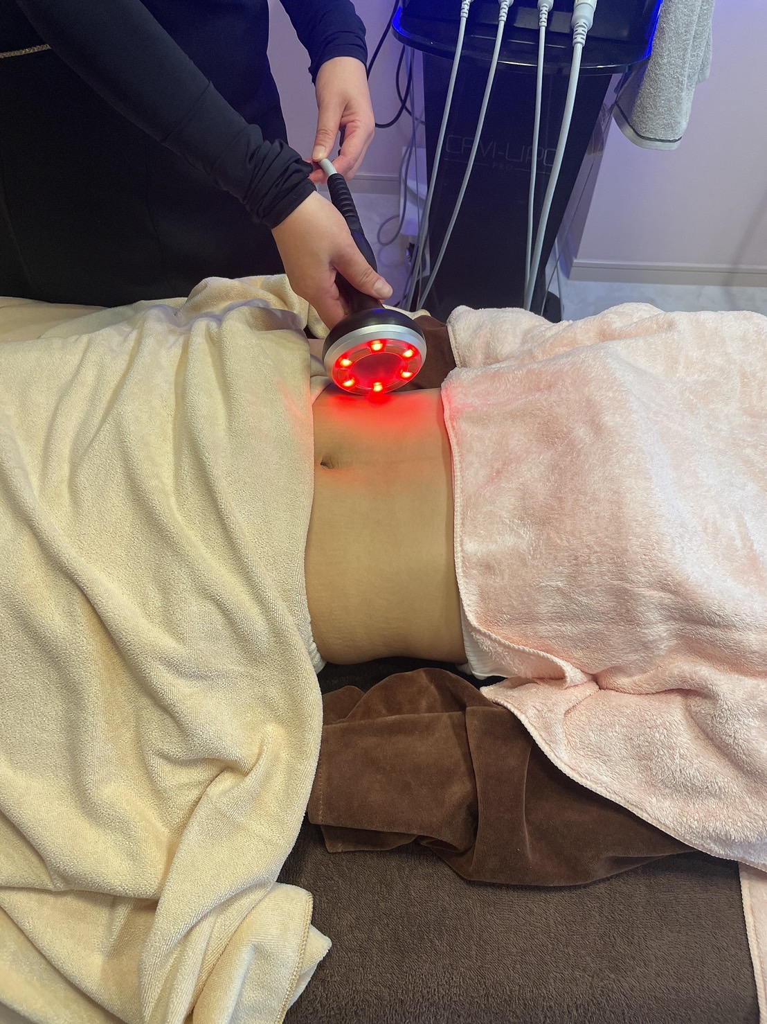 キャビリポプロ ボディ EMS＆サクション施術