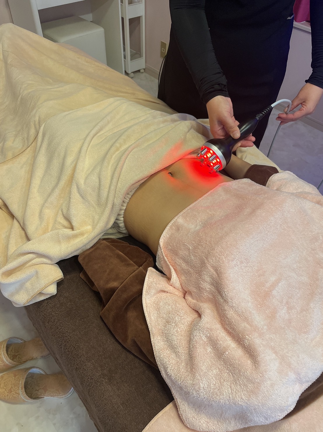 キャビリポプロ ボディ ラジオ波施術