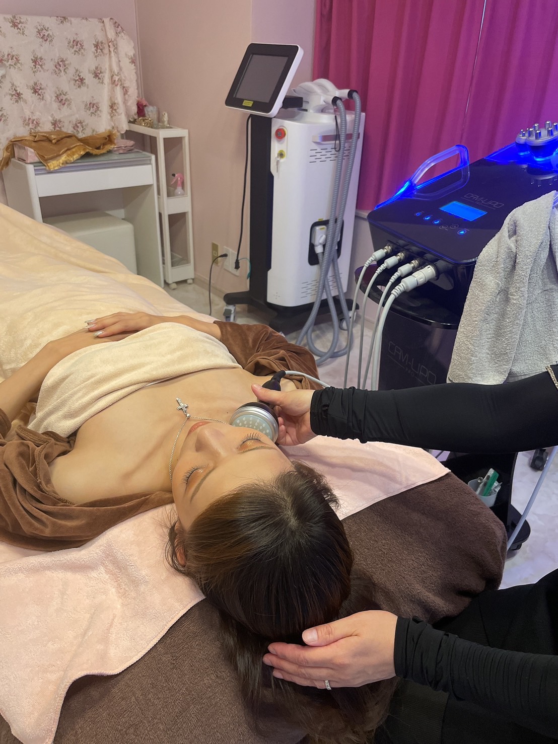 キャビリポプロ 顔 キャビテーション施術