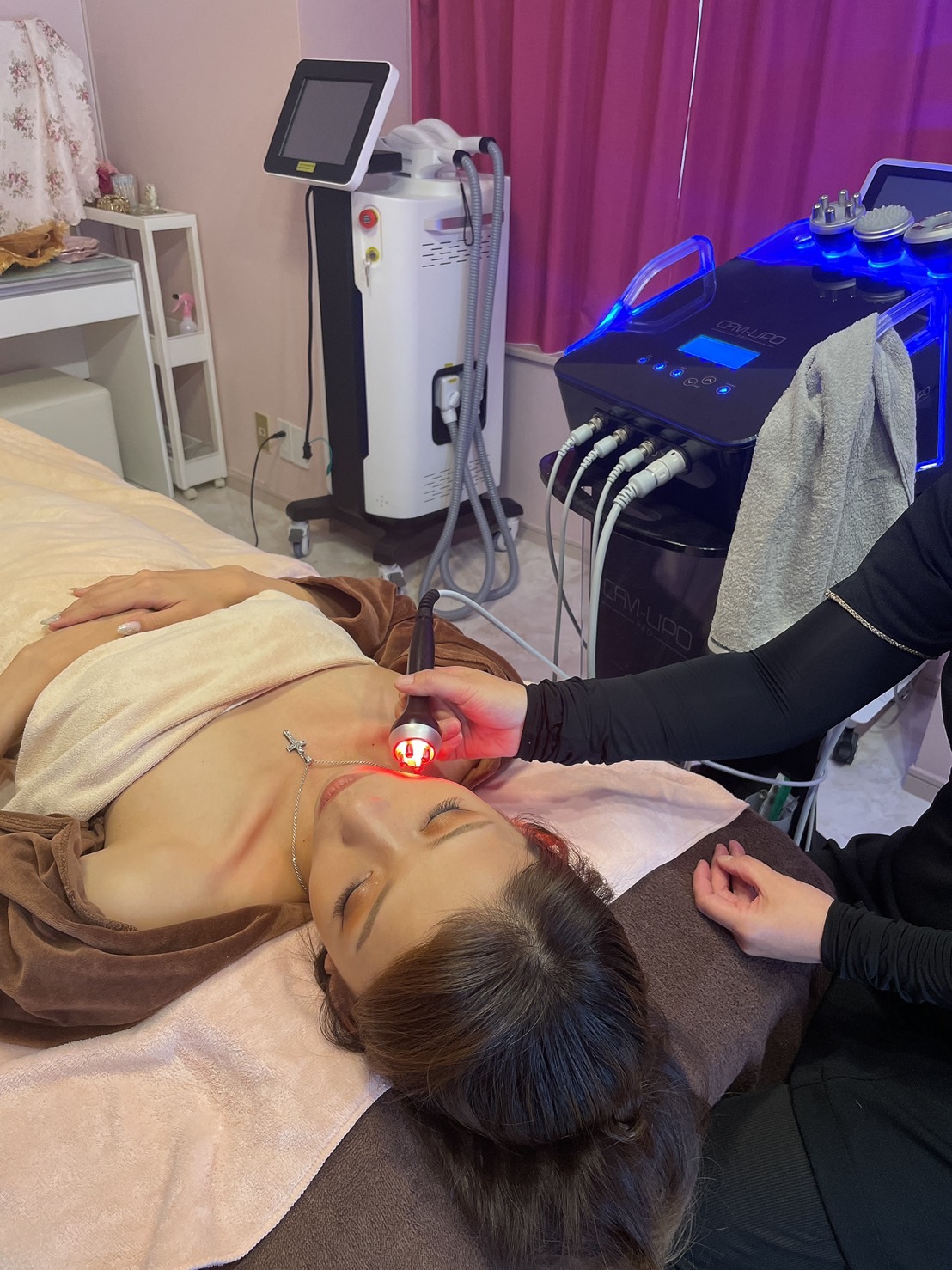 キャビリポプロ 顔 ラジオ波施術