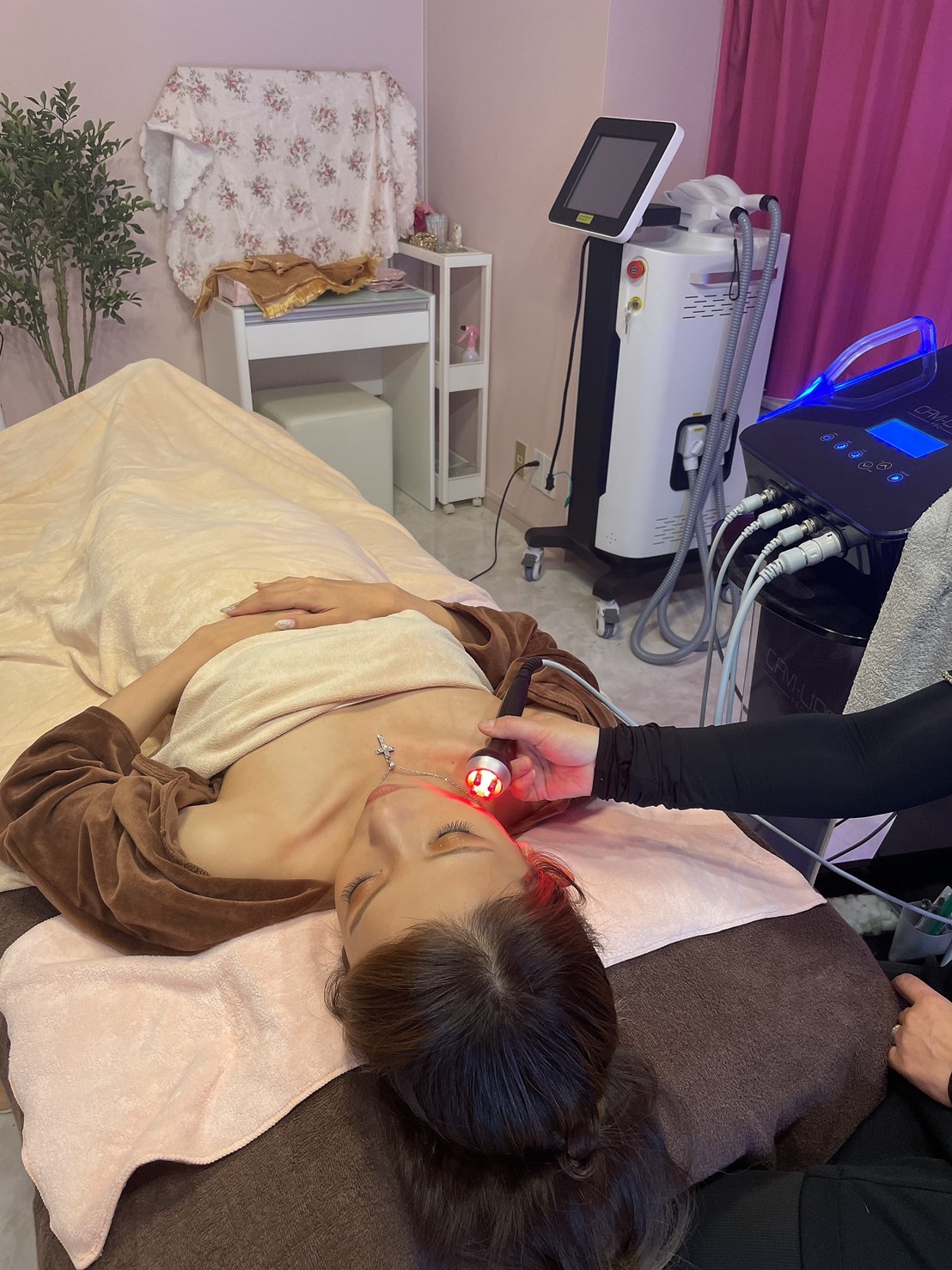 キャビリポプロ 顔 ラジオ波施術