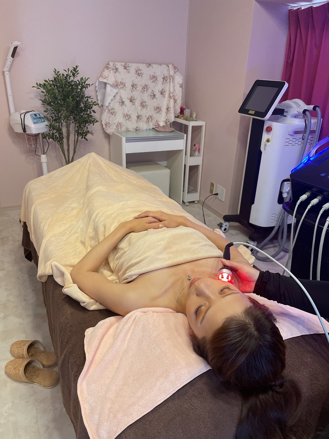 キャビリポプロ 顔 ラジオ波施術