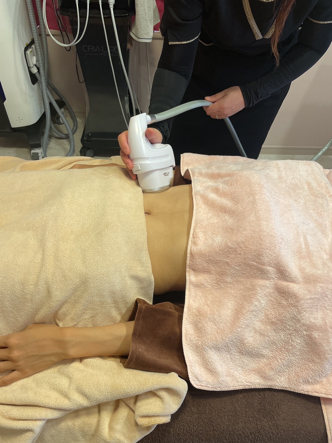 冷却ハイフ ボディ